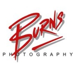 Burns_photo